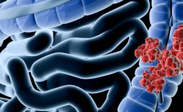 Gut Microbiome: Can it really affect our health?