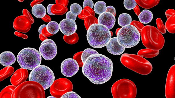 Vitamin D and the Immune system