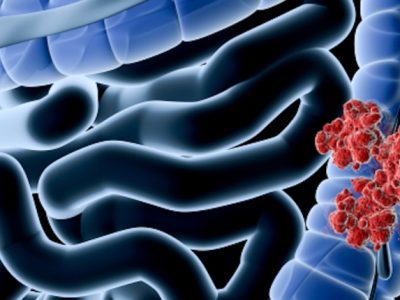 Gut Microbiome: Can it really affect our health?