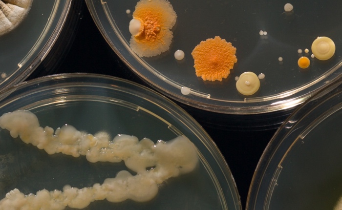 Gut microbiome- between host genetics and environmental determinants